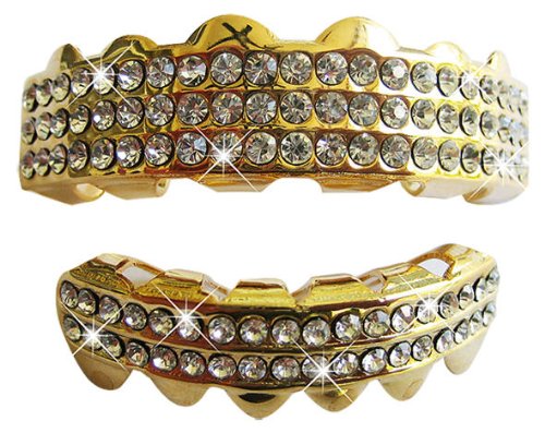 Hip Hop 14K Gold Plated Removeable Mouth Grillz Set (Top & Bottom) “Ballers Ice”